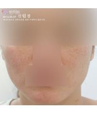 전후사진