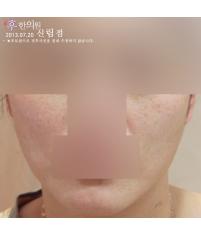 전후사진
