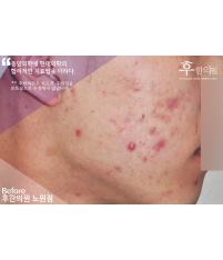 전후사진