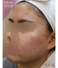 전후사진
