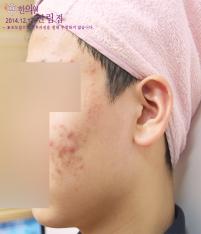 전후사진