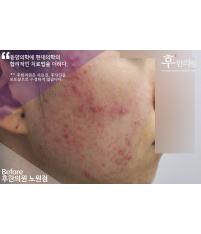전후사진