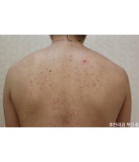 전후사진