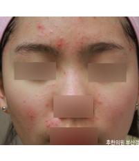 전후사진