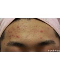 전후사진