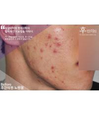 전후사진