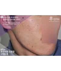 전후사진