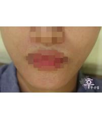 전후사진