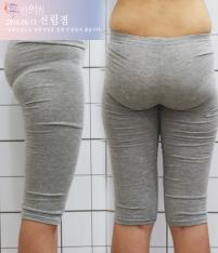 전후사진