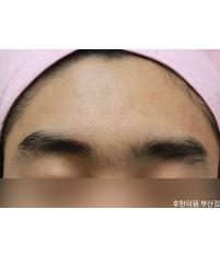 전후사진