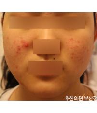 전후사진