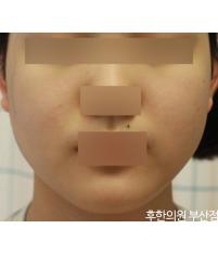 전후사진