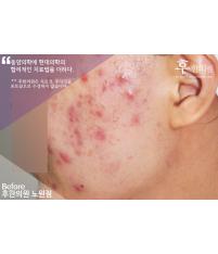 전후사진