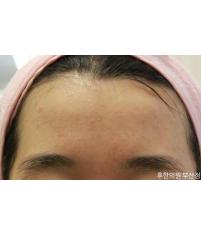전후사진