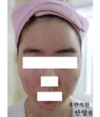 전후사진