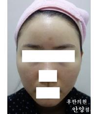 전후사진