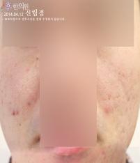전후사진