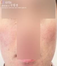 전후사진