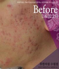전후사진