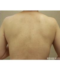 전후사진
