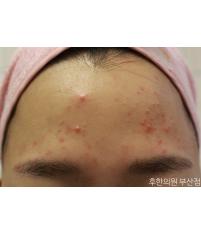 전후사진