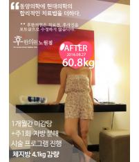 전후사진