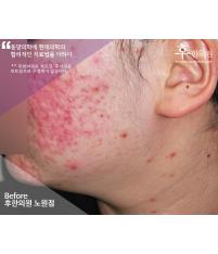 전후사진
