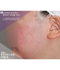 전후사진