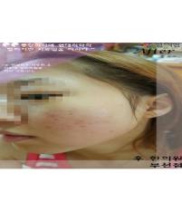 전후사진