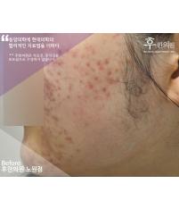 전후사진