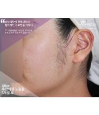 전후사진