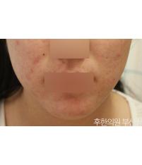 전후사진