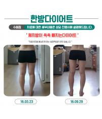 전후사진