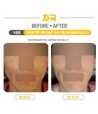 전후사진