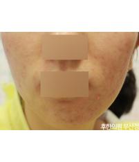 전후사진