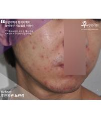 전후사진