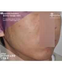 전후사진