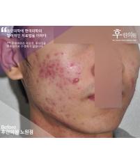 전후사진