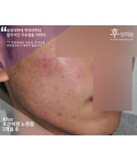 전후사진