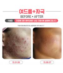 전후사진