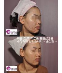 전후사진
