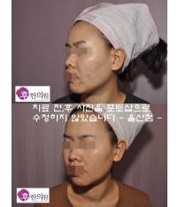 전후사진