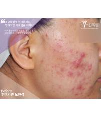 전후사진