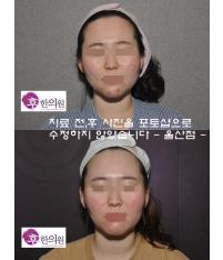전후사진