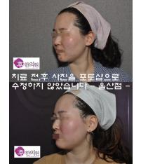 전후사진