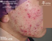 전후사진