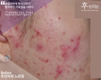 전후사진