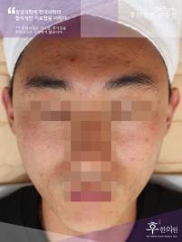 전후사진