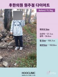 전후사진