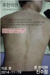 전후사진